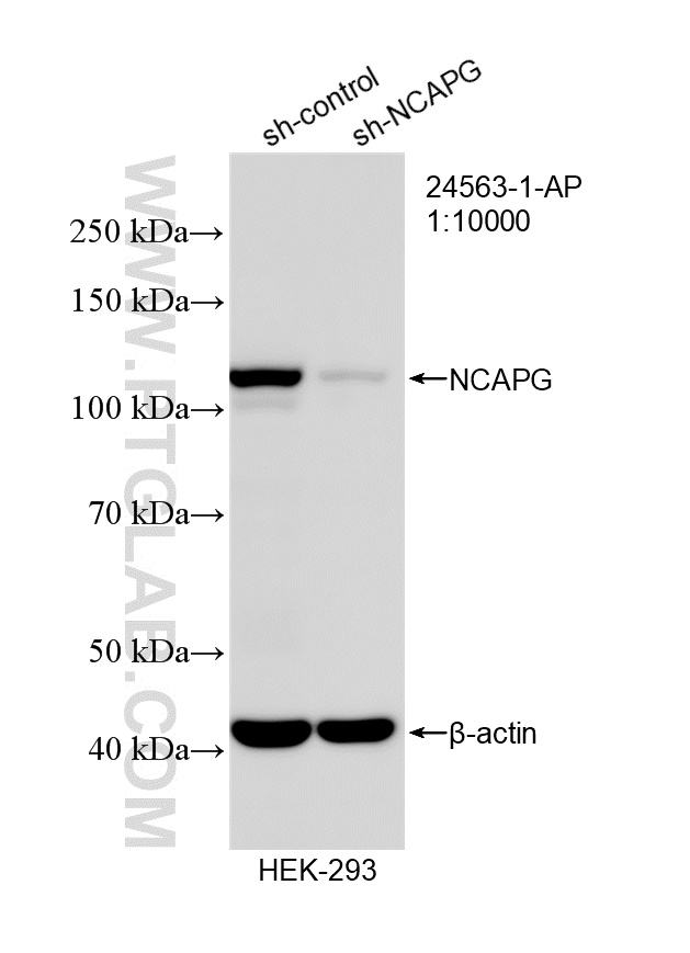 Western Blot (WB) analysis of HEK-293 cells using NCAPG Polyclonal antibody (24563-1-AP)