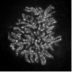 NCAPH2 antibody (mAb) (Clone 5F2G4) tested by immunofluorescence. Formaldehyde fixed HeLa cell stained with the NCAPH2 antibody.