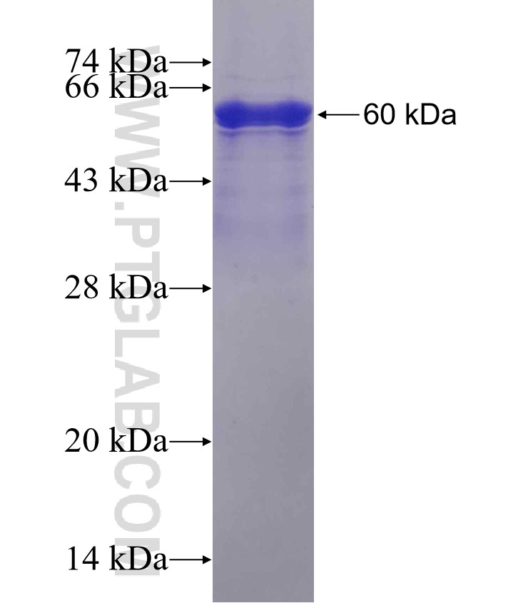 NCCRP1 fusion protein Ag23642 SDS-PAGE