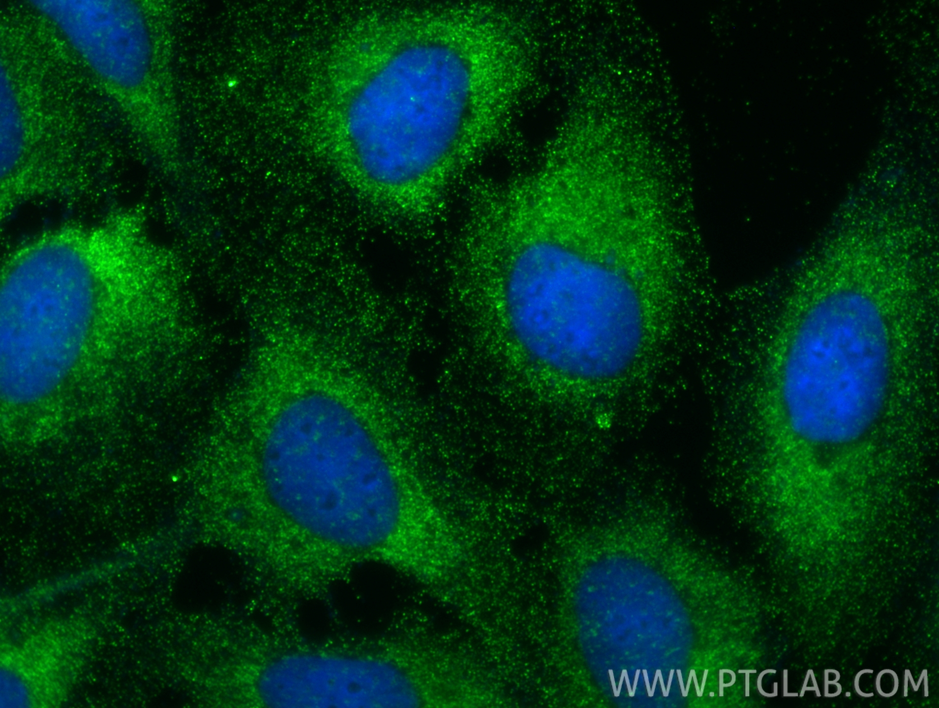 Immunofluorescence (IF) / fluorescent staining of U2OS cells using NOXA2/p67phox Polyclonal antibody (15551-1-AP)