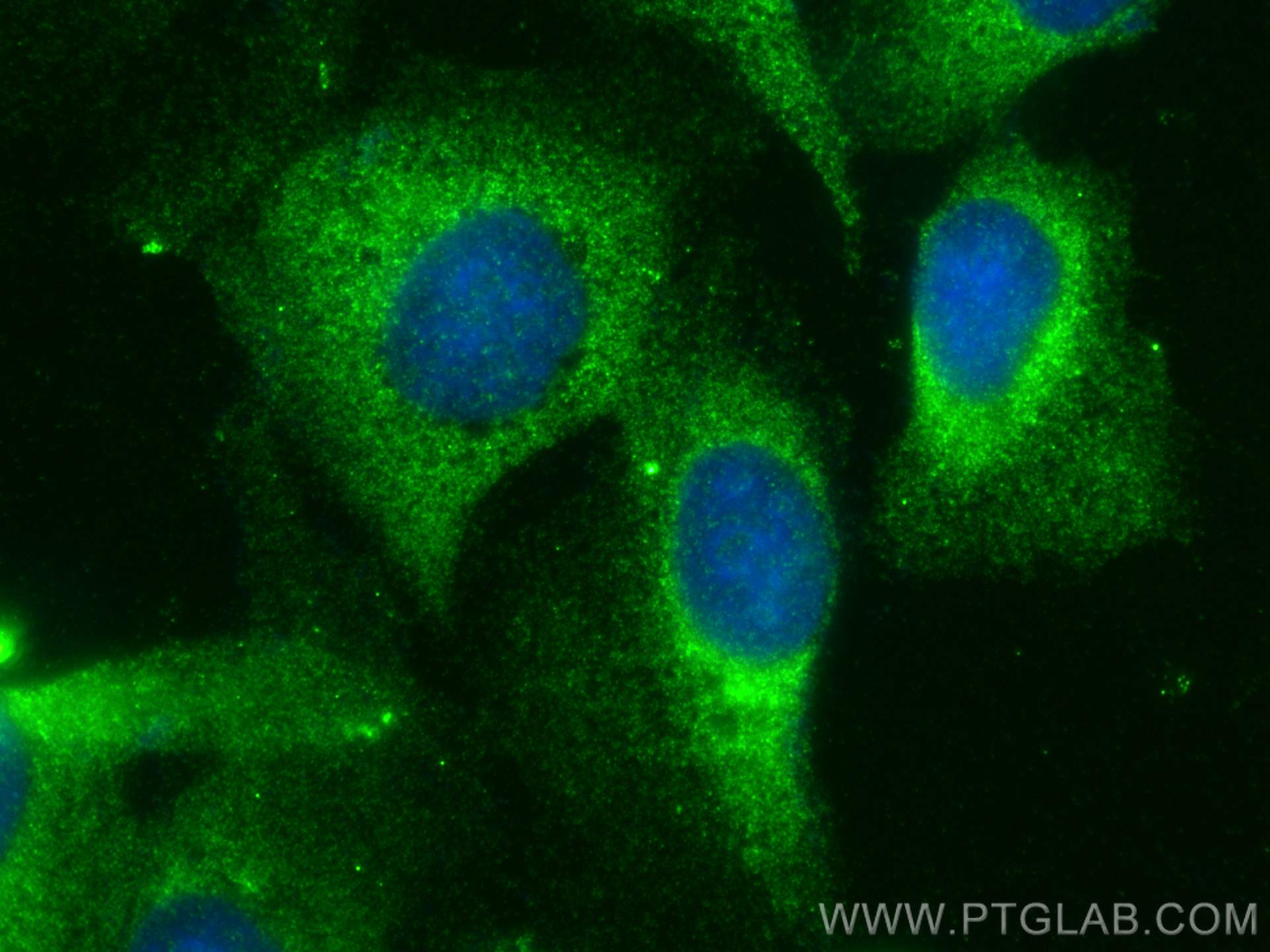 Immunofluorescence (IF) / fluorescent staining of U2OS cells using NCF4 Polyclonal antibody (14648-1-AP)