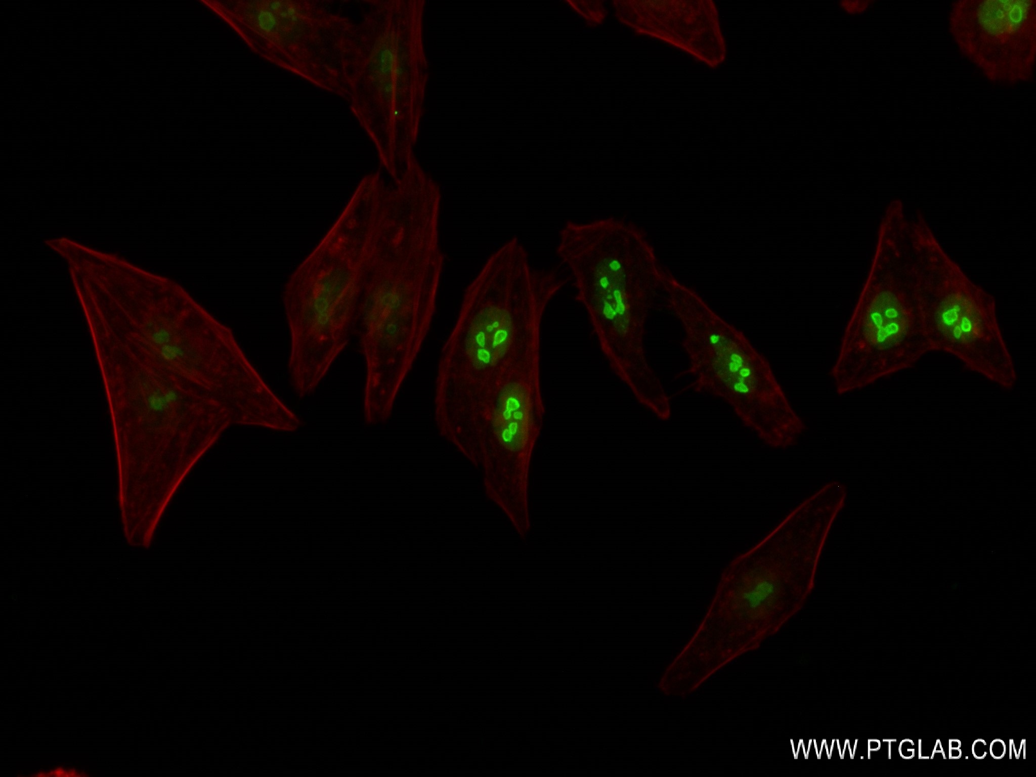 Immunofluorescence (IF) / fluorescent staining of HepG2 cells using Nucleolin/C23 Recombinant antibody (83380-1-RR)