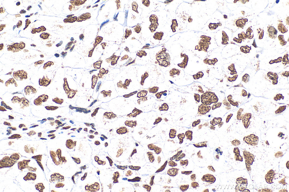 Nucleolin/C23