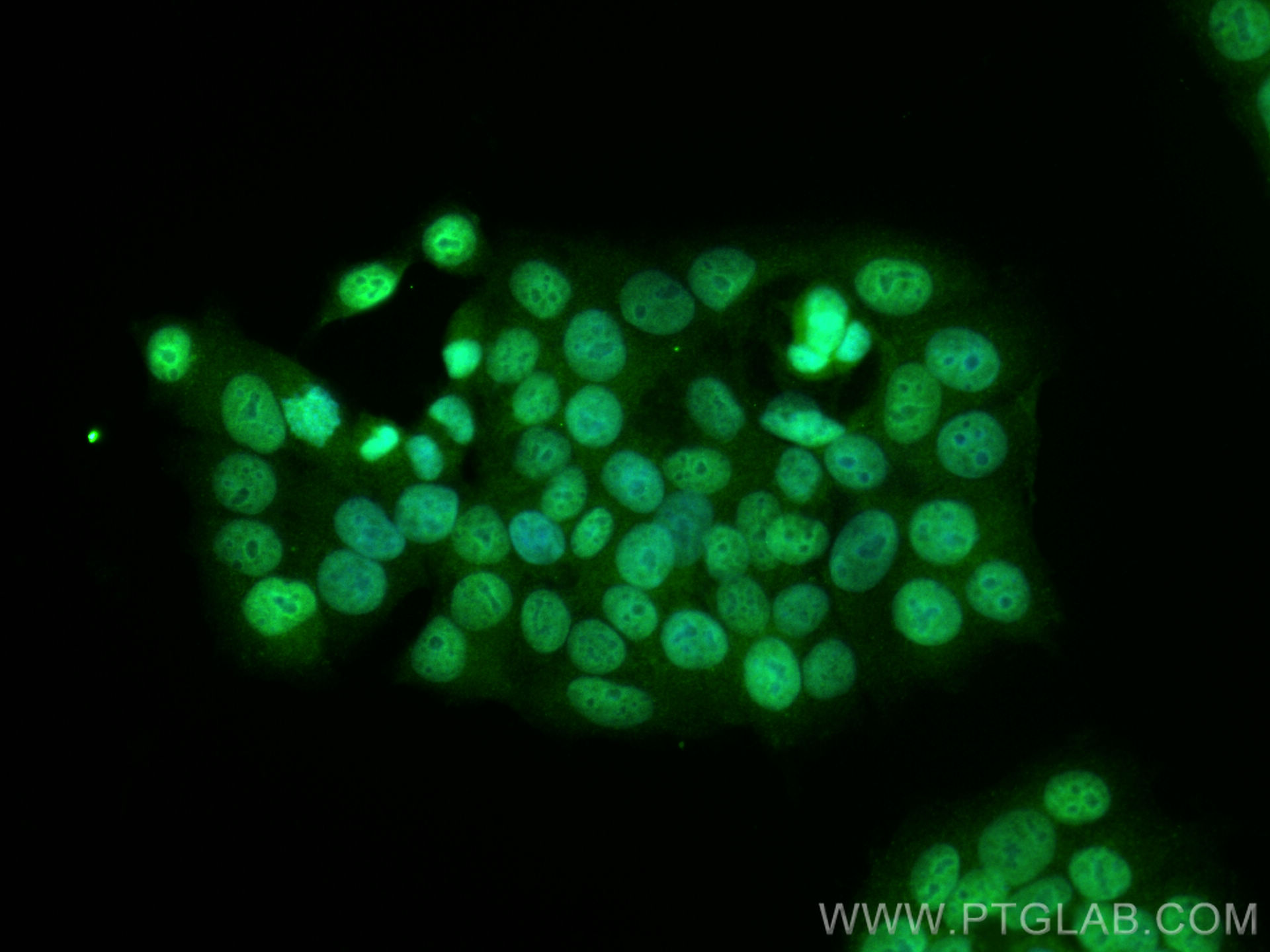 Immunofluorescence (IF) / fluorescent staining of MCF-7 cells using NCOA4 Polyclonal antibody (10968-1-AP)