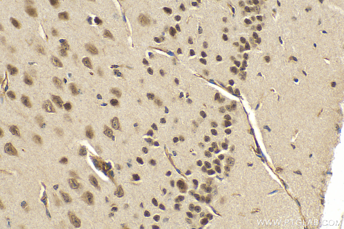 Immunohistochemistry (IHC) staining of mouse brain tissue using NCOA4 Polyclonal antibody (10968-1-AP)