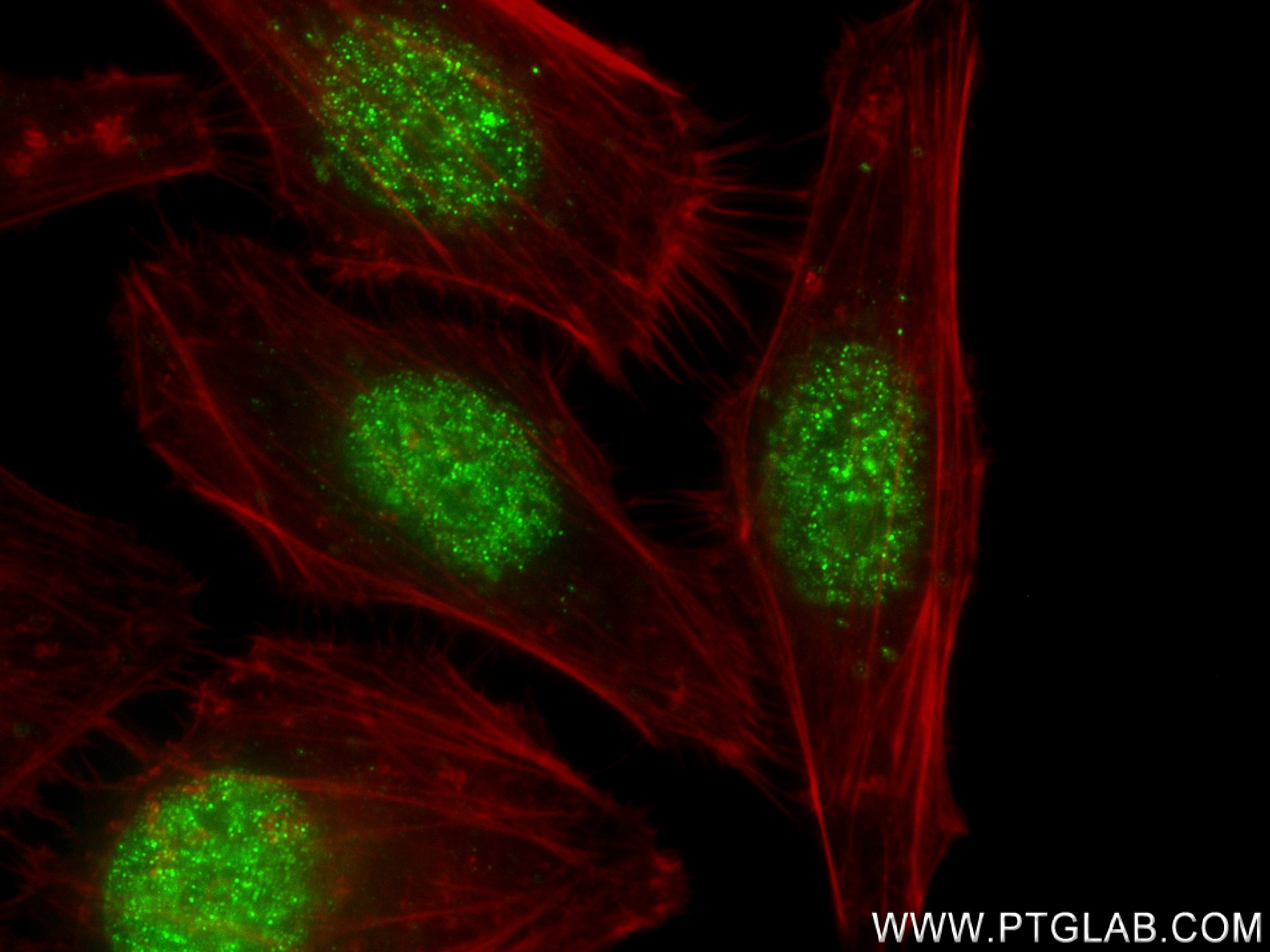 Immunofluorescence (IF) / fluorescent staining of HepG2 cells using NCOA4 Recombinant antibody (83394-4-RR)