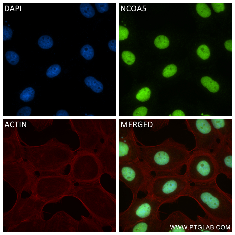 Immunofluorescence (IF) / fluorescent staining of A431 cells using NCOA5 Recombinant antibody (85004-1-RR)