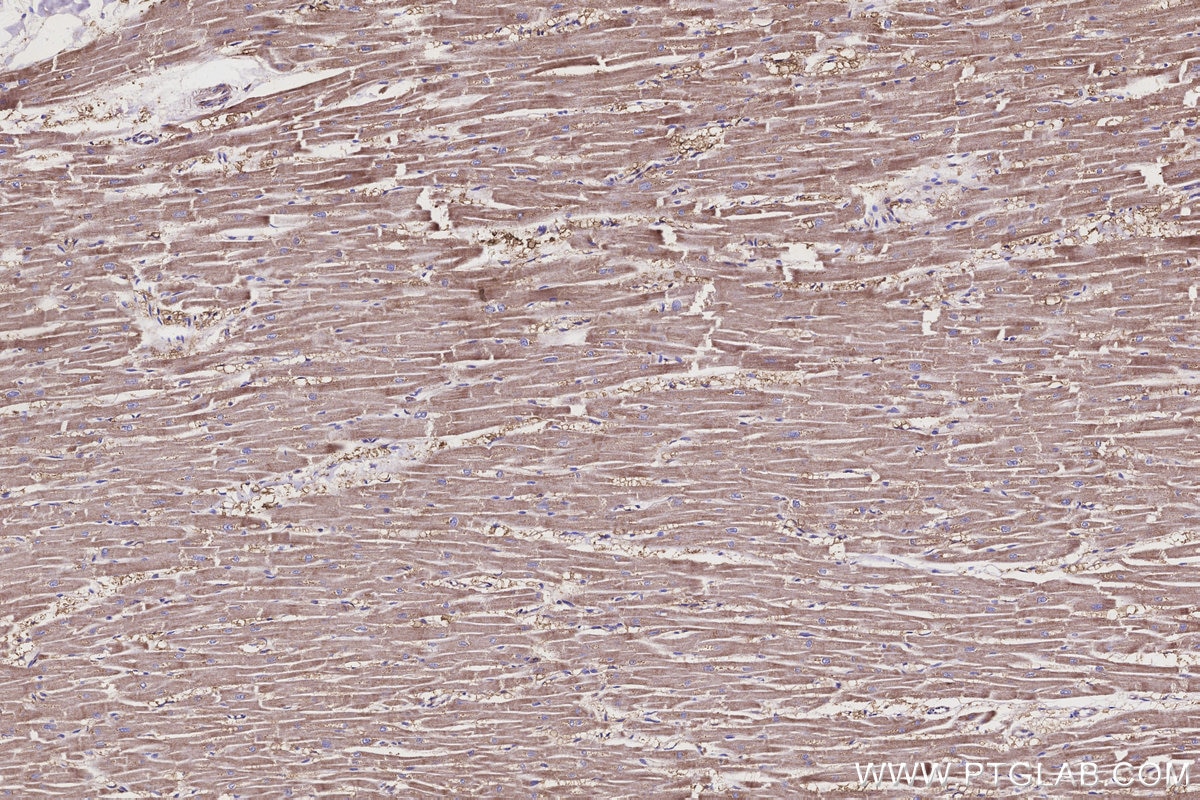 Immunohistochemistry (IHC) staining of human heart tissue using ND1 Polyclonal antibody (19703-1-AP)