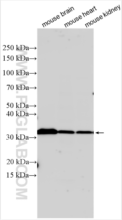 Western Blot (WB) analysis of various lysates using ND1 Polyclonal antibody (19703-1-AP)