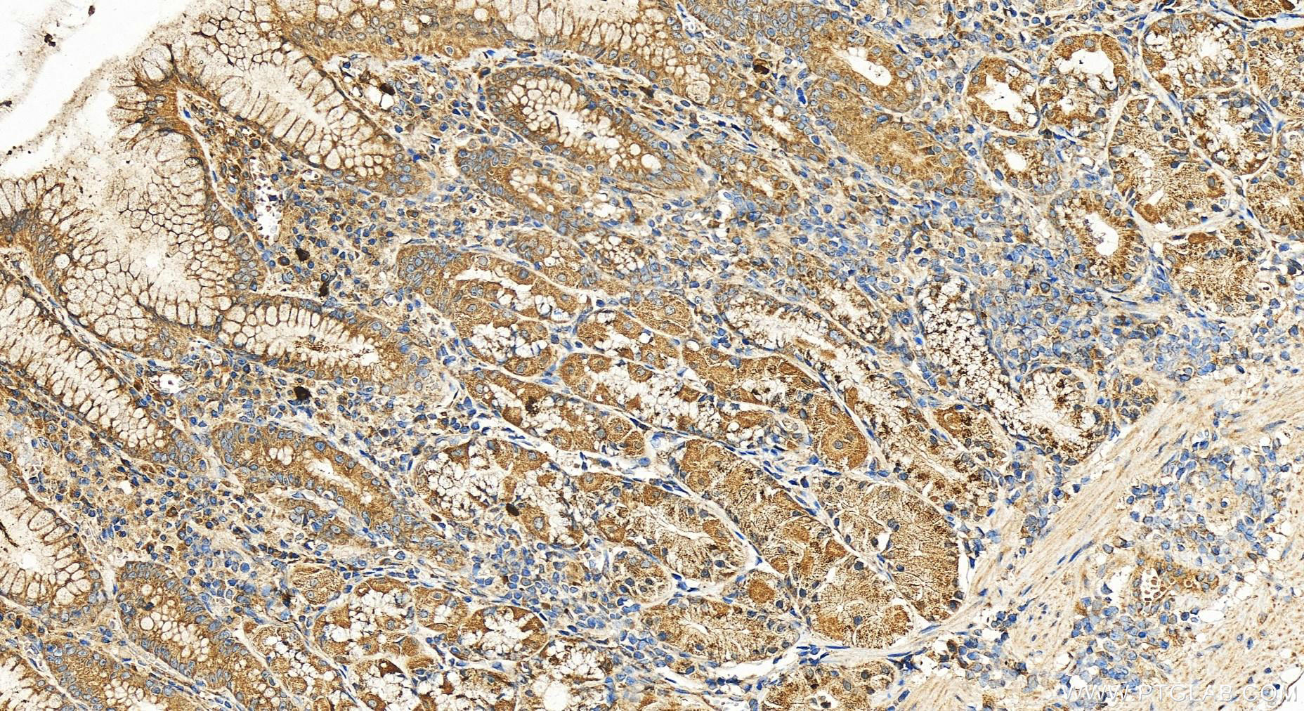 Immunohistochemistry (IHC) staining of human stomach tissue using ND2 Polyclonal antibody (19704-1-AP)