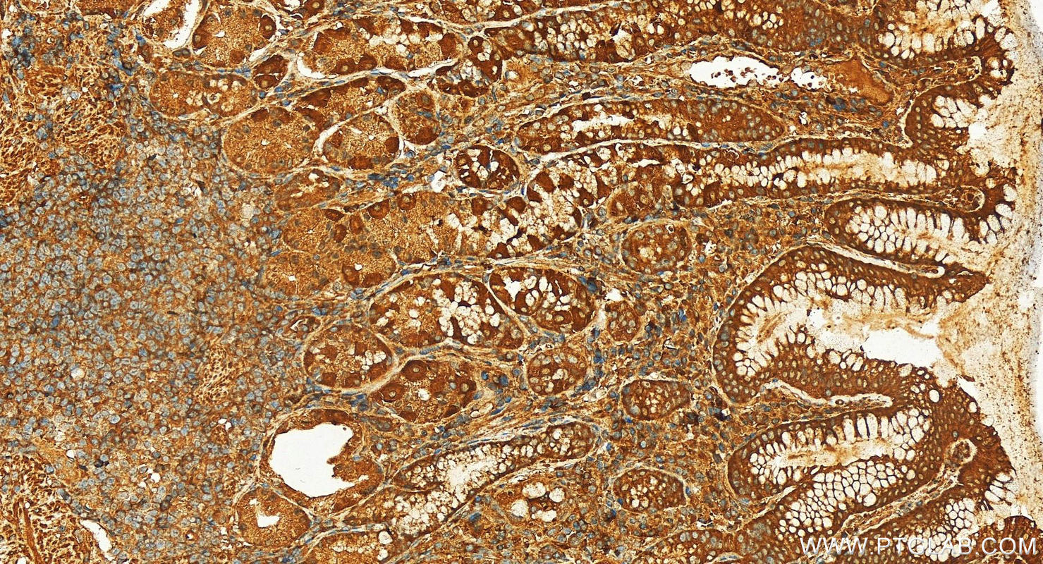 Immunohistochemistry (IHC) staining of human stomach tissue using ND4 Polyclonal antibody (26736-1-AP)