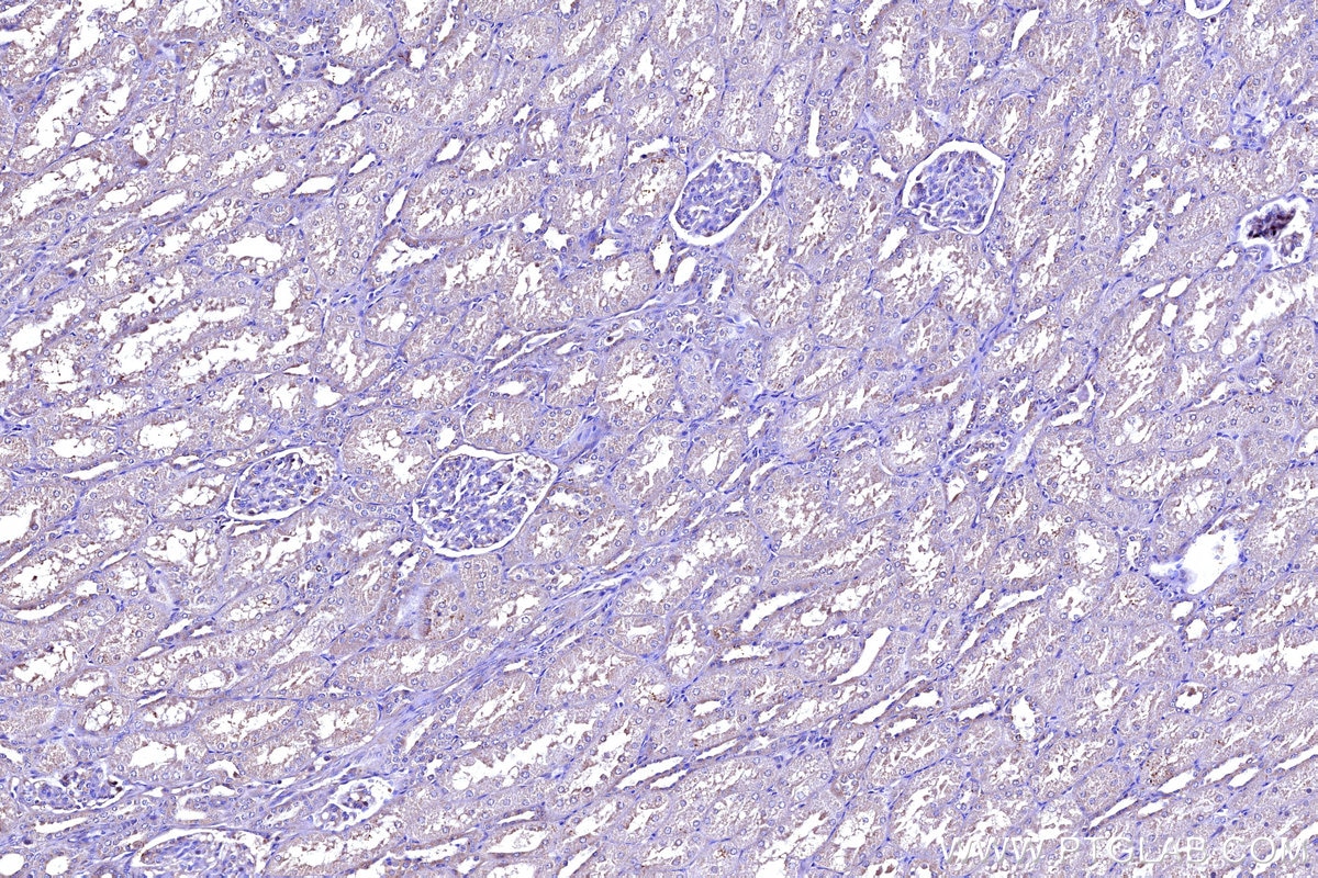 Immunohistochemistry (IHC) staining of human kidney tissue using MT-ND5 Polyclonal antibody (55410-1-AP)