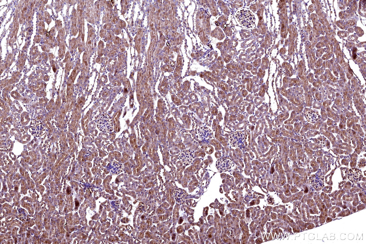 Immunohistochemistry (IHC) staining of mouse kidney tissue using MT-ND5 Polyclonal antibody (55410-1-AP)