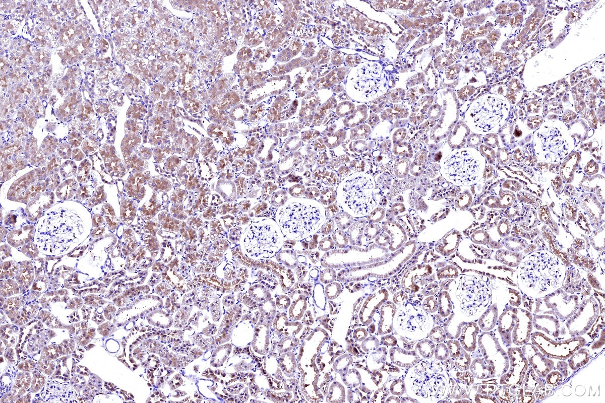 Immunohistochemistry (IHC) staining of rat kidney tissue using MT-ND5 Polyclonal antibody (55410-1-AP)