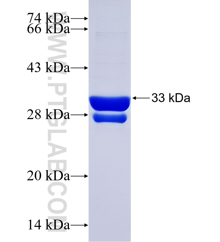 ND5 fusion protein Ag34495 SDS-PAGE