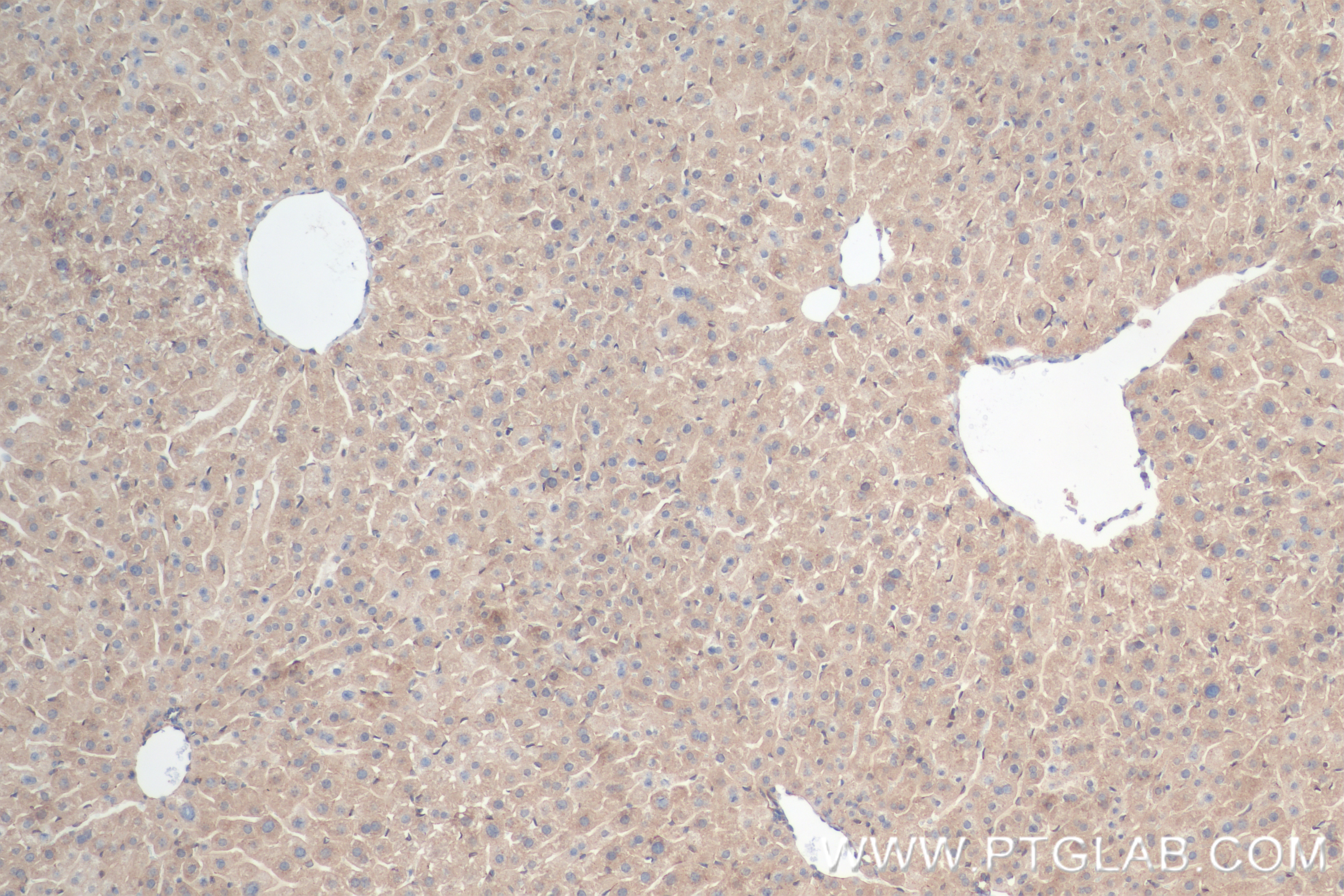 Immunohistochemistry (IHC) staining of mouse liver tissue using NDE1 Recombinant antibody (84799-4-RR)