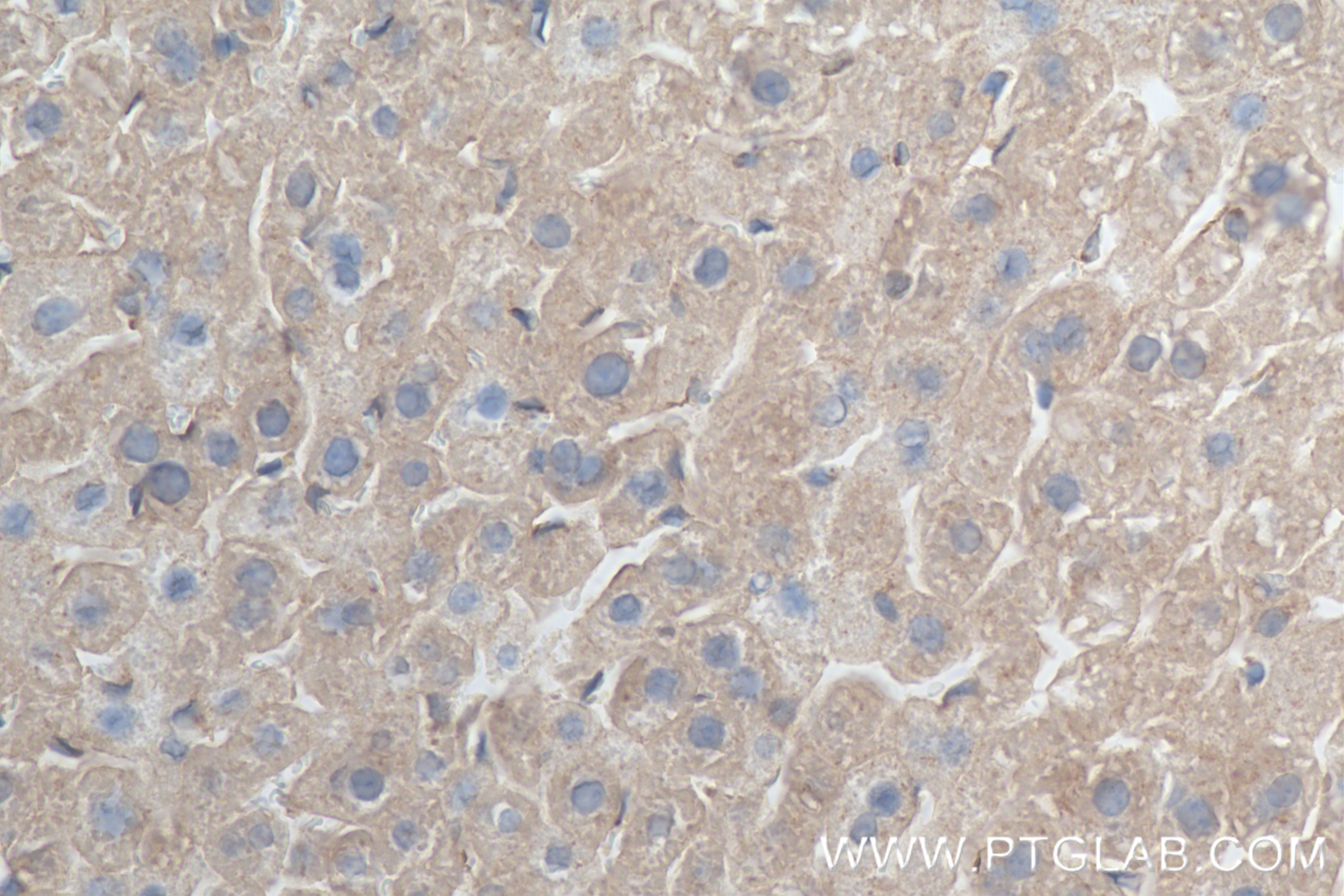 Immunohistochemistry (IHC) staining of mouse liver tissue using NDE1 Recombinant antibody (84799-4-RR)