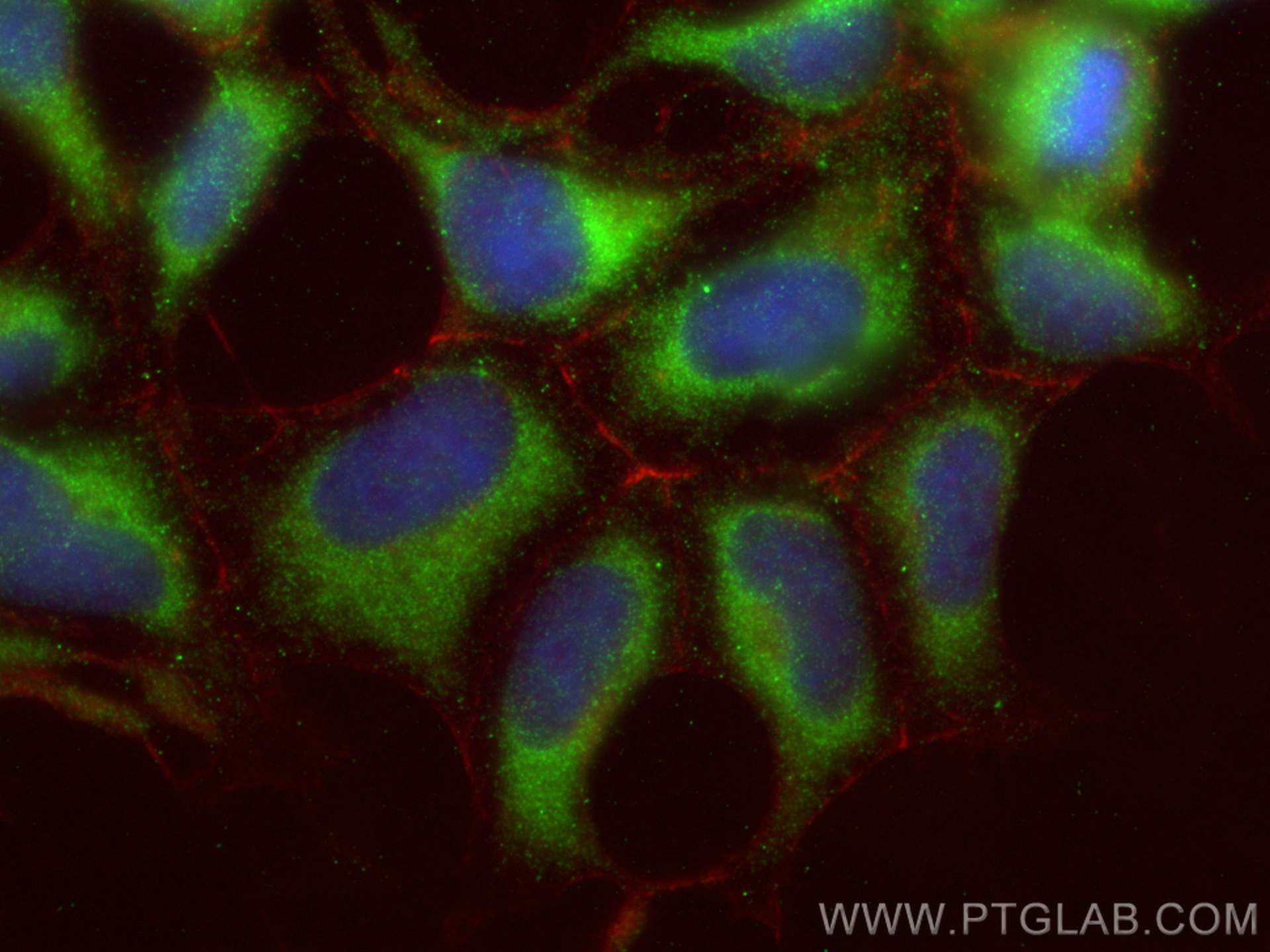 Immunofluorescence (IF) / fluorescent staining of HEK-293 cells using NDFIP1 Polyclonal antibody (15602-1-AP)