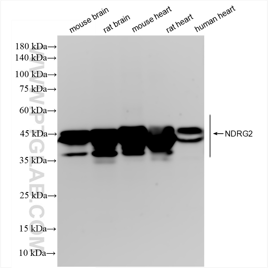 Western Blot (WB) analysis of various lysates using NDRG2 Recombinant antibody (83902-7-RR)