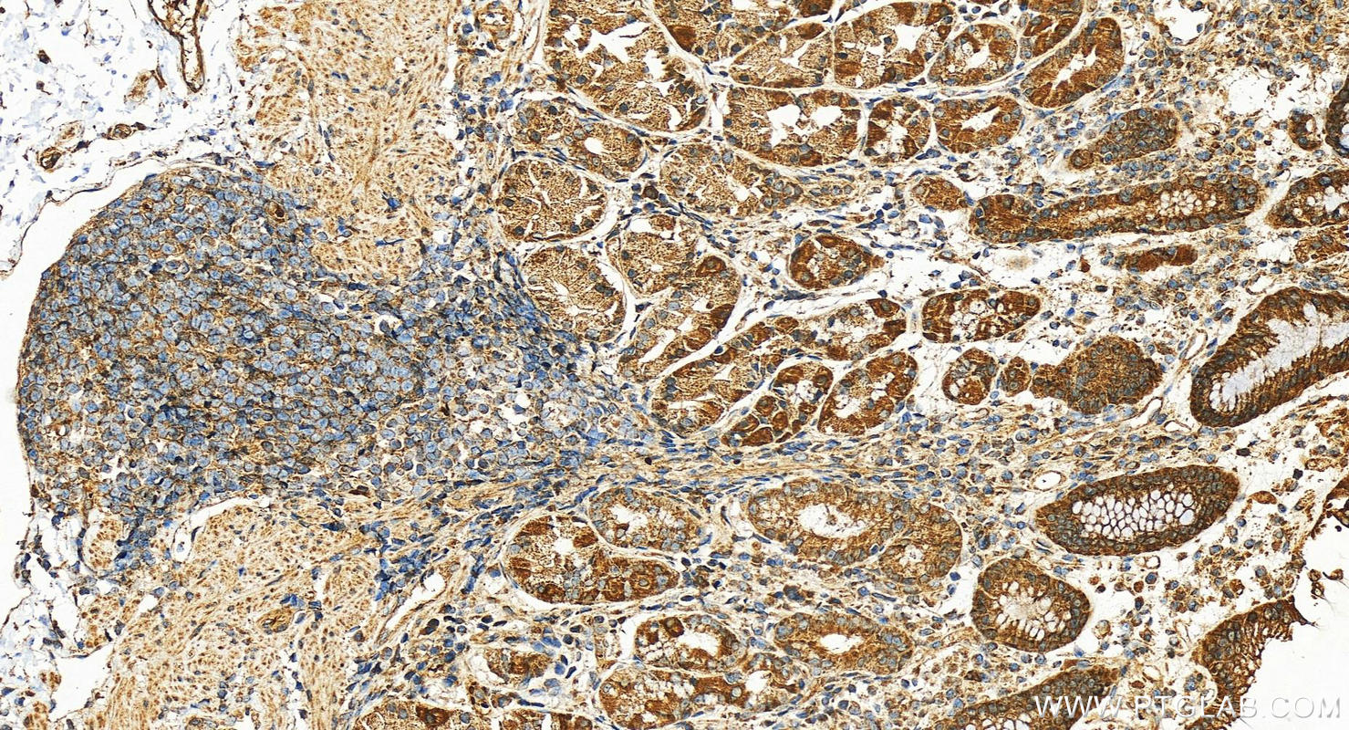 Immunohistochemistry (IHC) staining of human stomach tissue using NDUFA3 Polyclonal antibody (17257-1-AP)