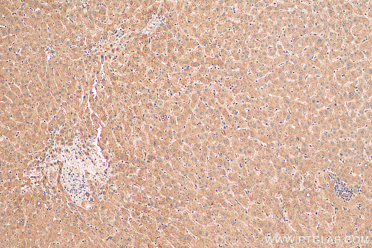 Immunohistochemistry (IHC) staining of human liver tissue using NDUFA3 Polyclonal antibody (17257-1-AP)