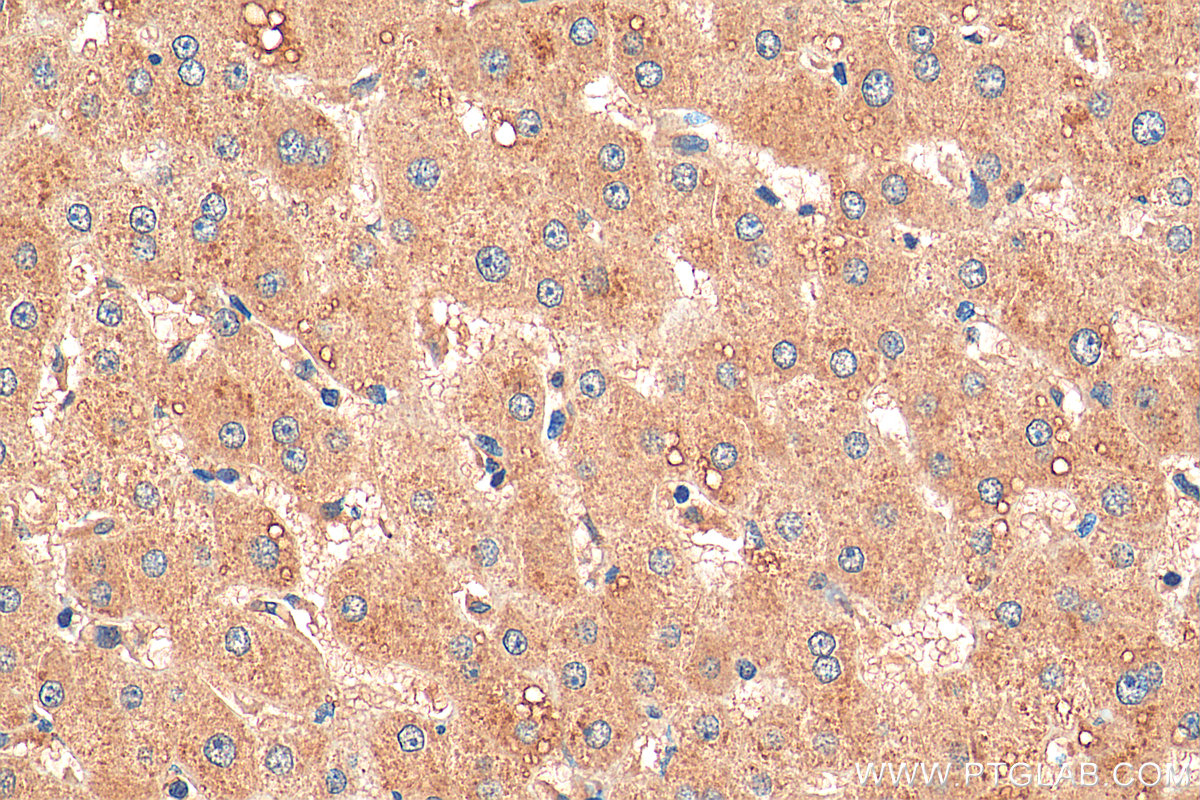 Immunohistochemistry (IHC) staining of human liver tissue using NDUFA3 Polyclonal antibody (17257-1-AP)