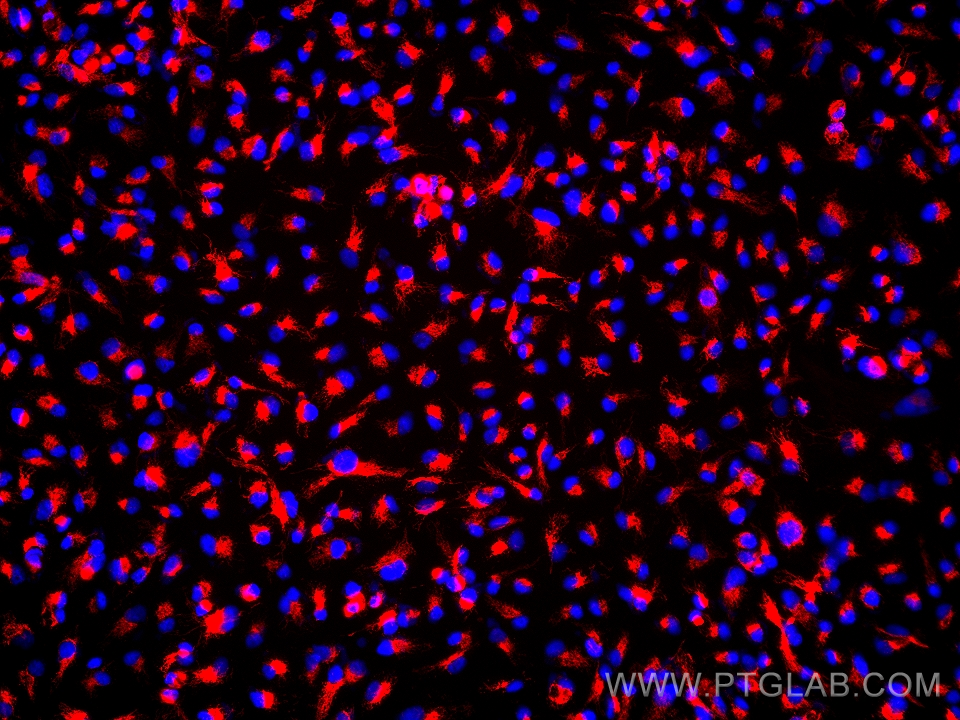 Immunofluorescence (IF) / fluorescent staining of OS-RC-2 cells using NDUFA4L2 Monoclonal antibody (66050-1-Ig)