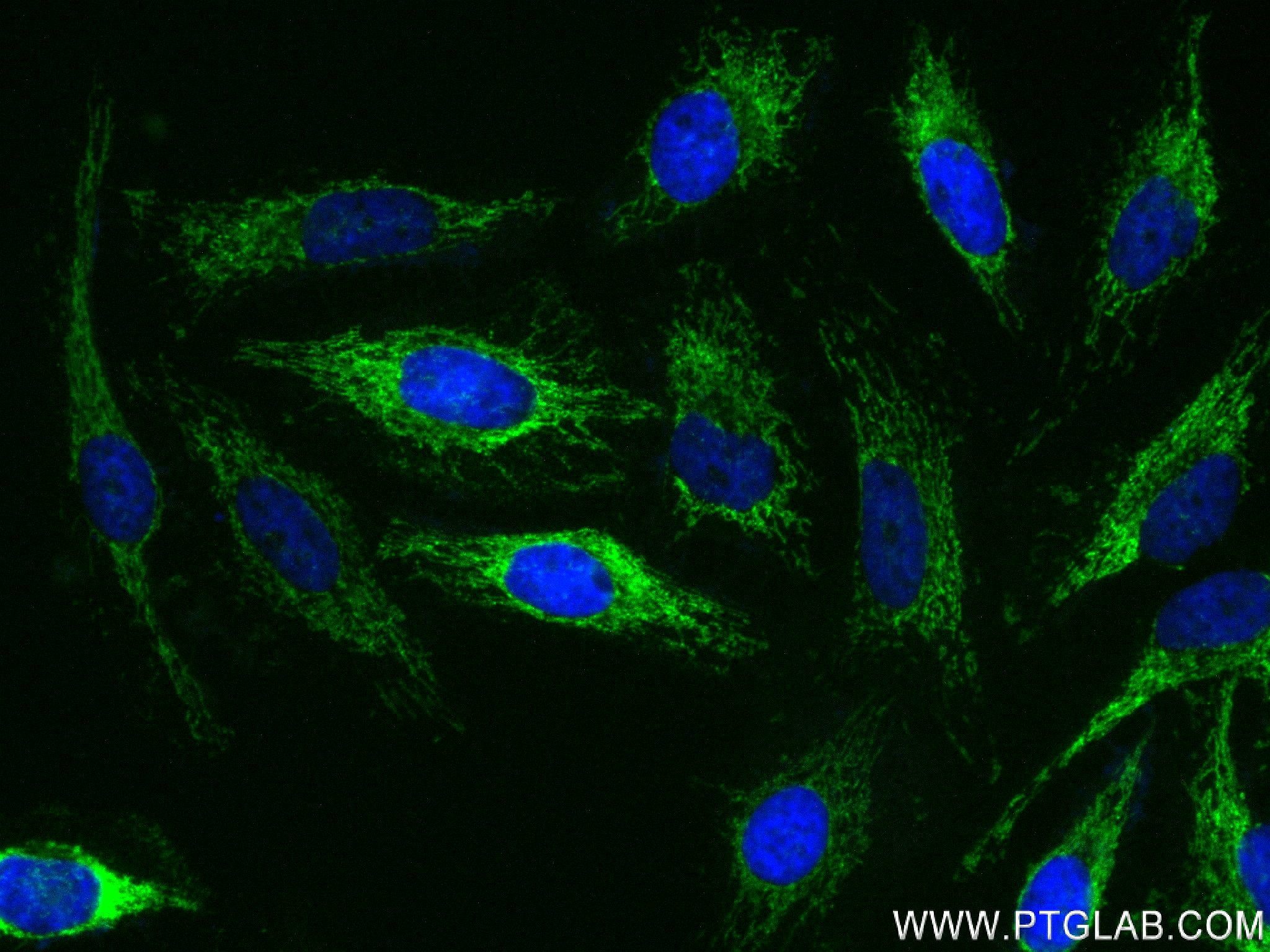 Immunofluorescence (IF) / fluorescent staining of HeLa cells using NDUFA4L2 Recombinant antibody (84498-1-RR)