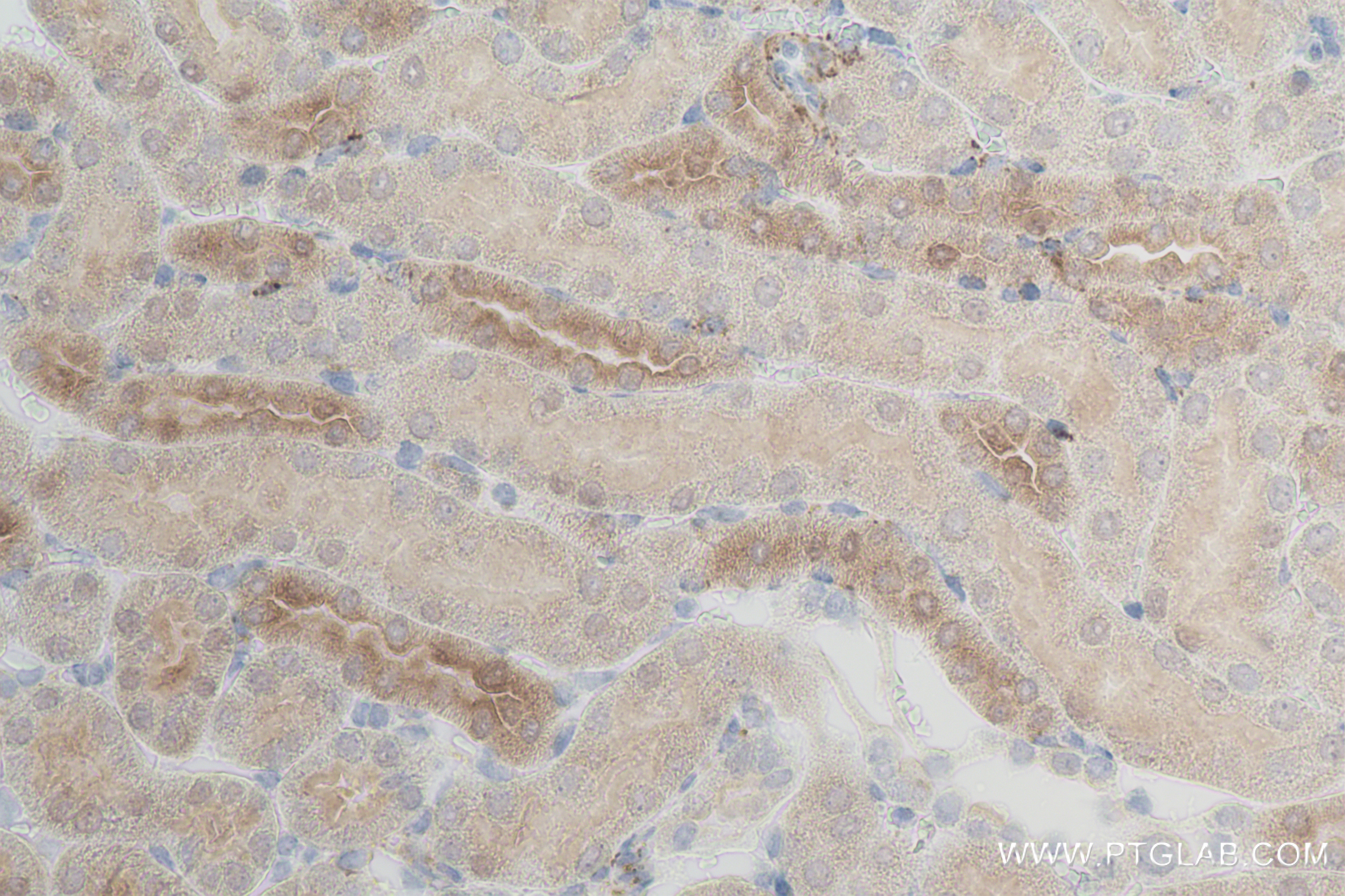 Immunohistochemistry (IHC) staining of mouse kidney tissue using NDUFA4L2 Recombinant antibody (84498-1-RR)