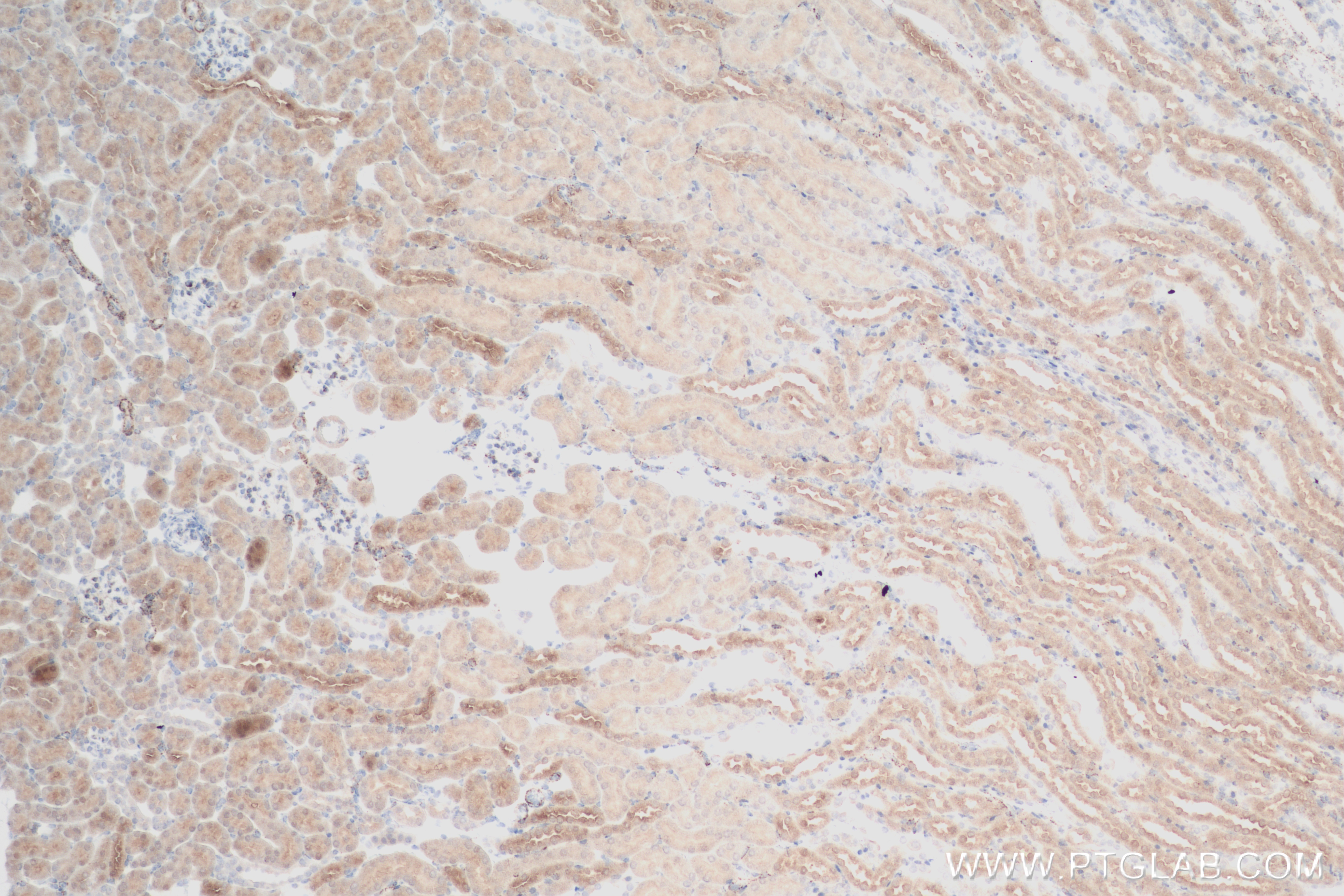 Immunohistochemistry (IHC) staining of mouse kidney tissue using NDUFA4L2 Recombinant antibody (84498-1-RR)