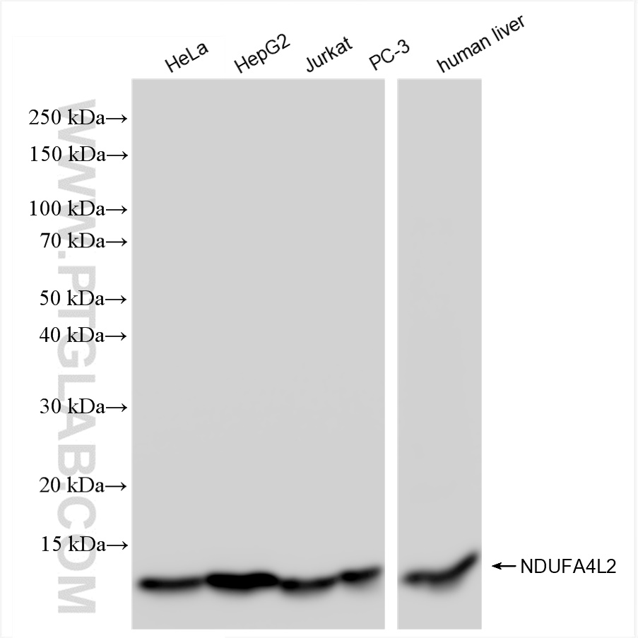 Western Blot (WB) analysis of various lysates using NDUFA4L2 Recombinant antibody (84498-1-RR)