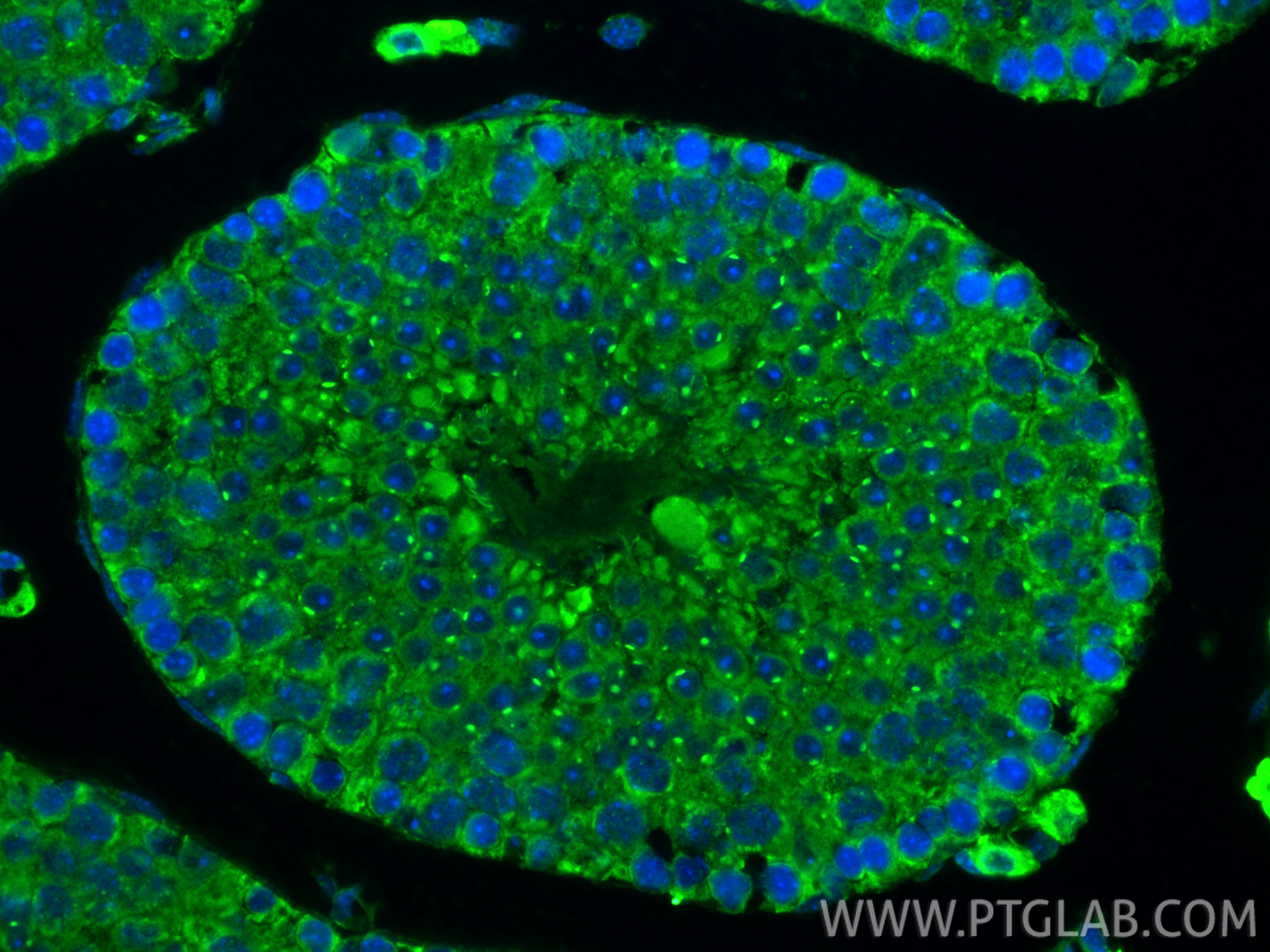 Immunofluorescence (IF) / fluorescent staining of mouse testis tissue using NDUFA9 Polyclonal antibody (20312-1-AP)