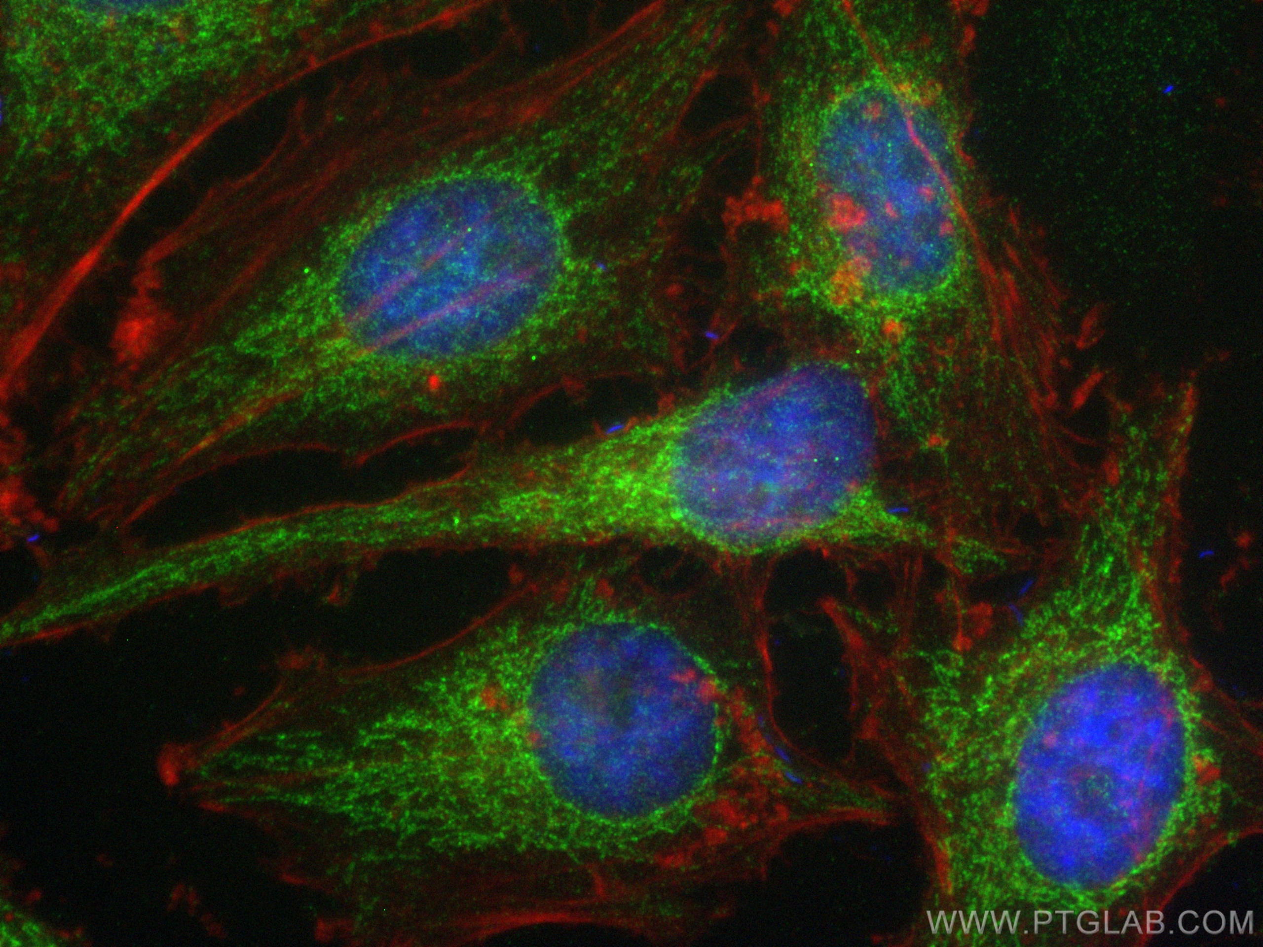 Immunofluorescence (IF) / fluorescent staining of HeLa cells using NDUFAF3 Polyclonal antibody (25621-1-AP)