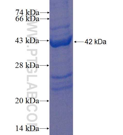 NDUFAF3 fusion protein Ag22514 SDS-PAGE