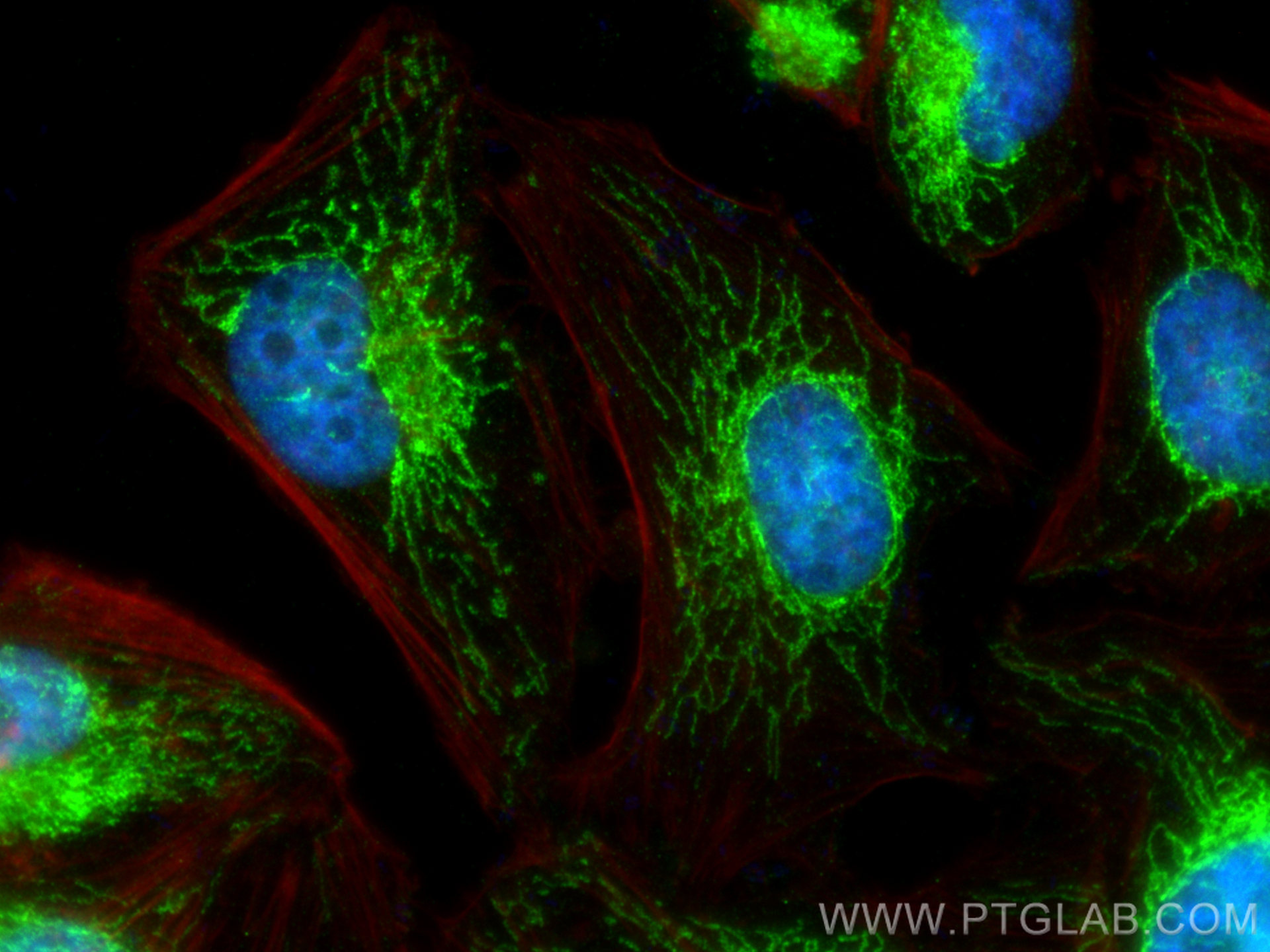 Immunofluorescence (IF) / fluorescent staining of HeLa cells using NDUFB4 Polyclonal antibody (27931-1-AP)