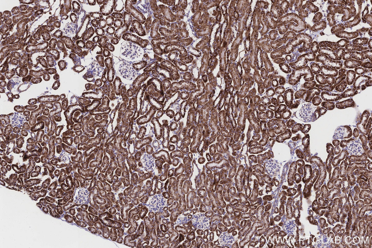 Immunohistochemistry (IHC) staining of mouse kidney tissue using NDUFB8 Recombinant monoclonal antibody (83216-3-RR)