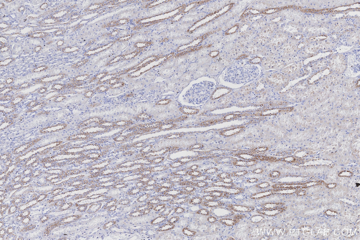 Immunohistochemistry (IHC) staining of human kidney tissue using NDUFB8 Recombinant monoclonal antibody (83216-3-RR)