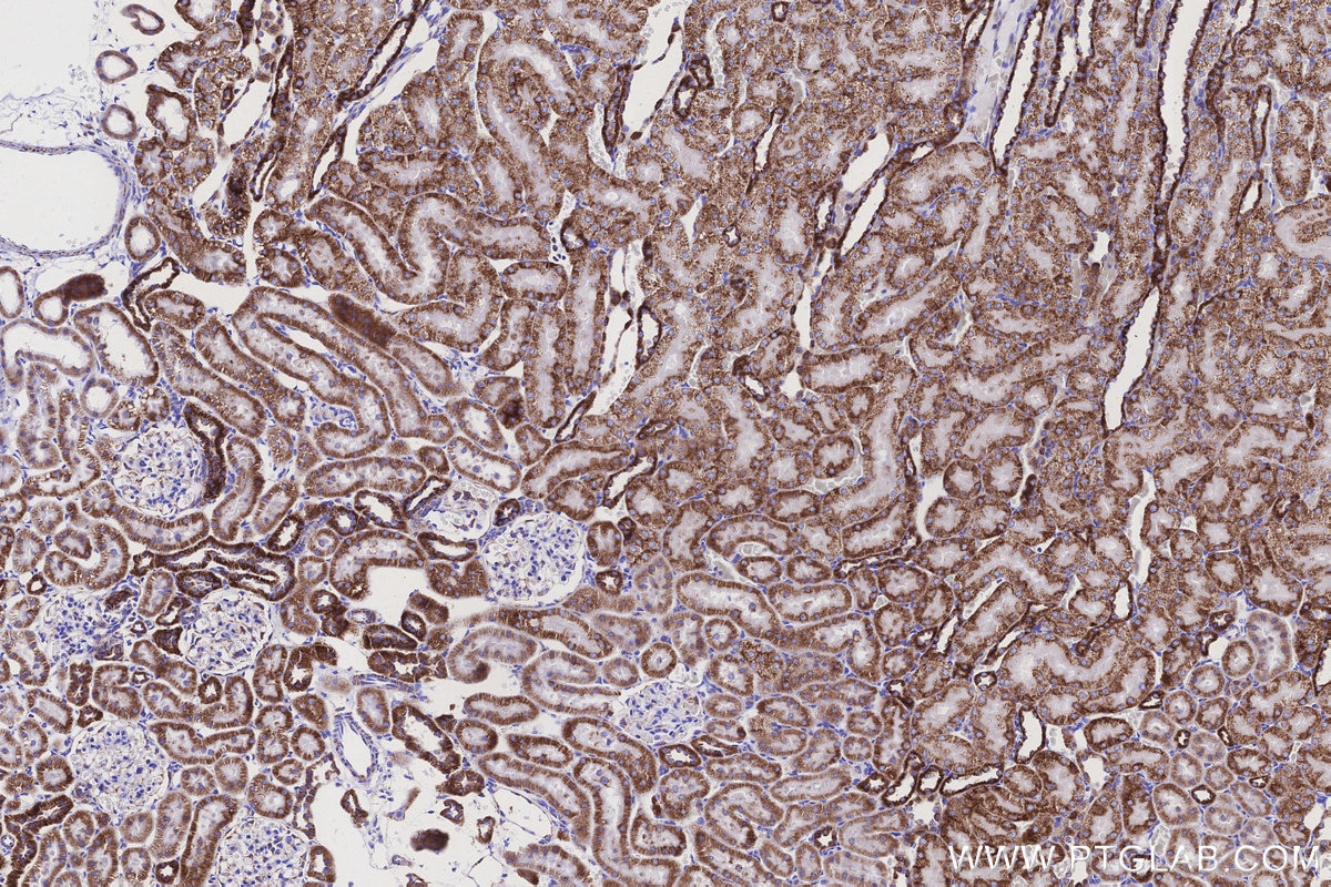 Immunohistochemistry (IHC) staining of rat kidney tissue using NDUFB8 Recombinant monoclonal antibody (83216-3-RR)