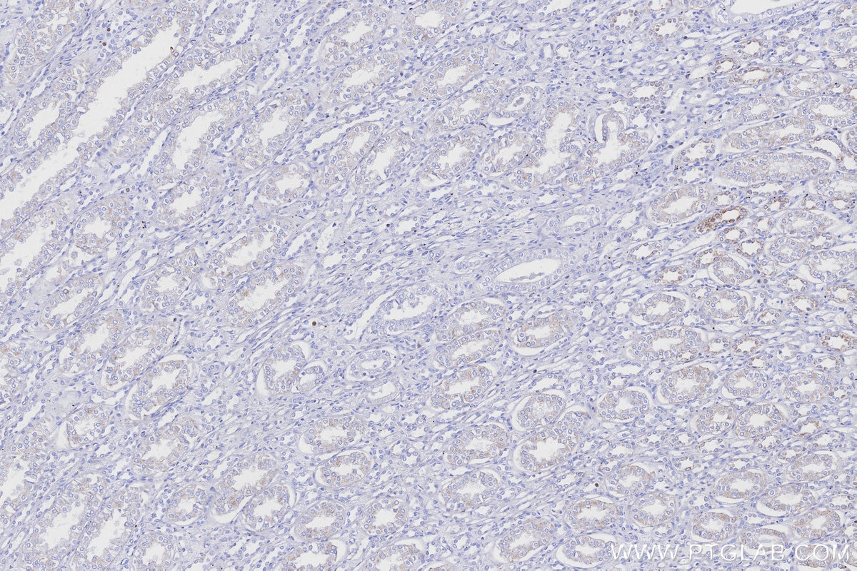 Immunohistochemistry (IHC) staining of human kidney tissue using NDUFB8 Recombinant monoclonal antibody (83216-3-RR)