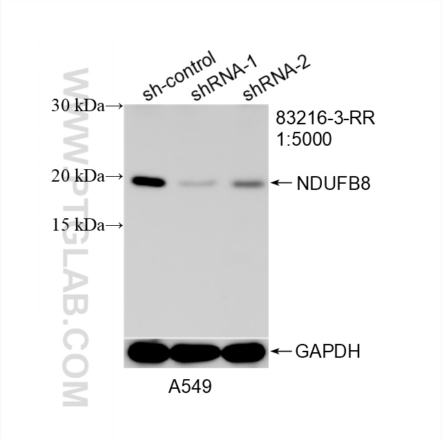 Western Blot (WB) analysis of A549 cells using NDUFB8 Recombinant antibody (83216-3-RR)