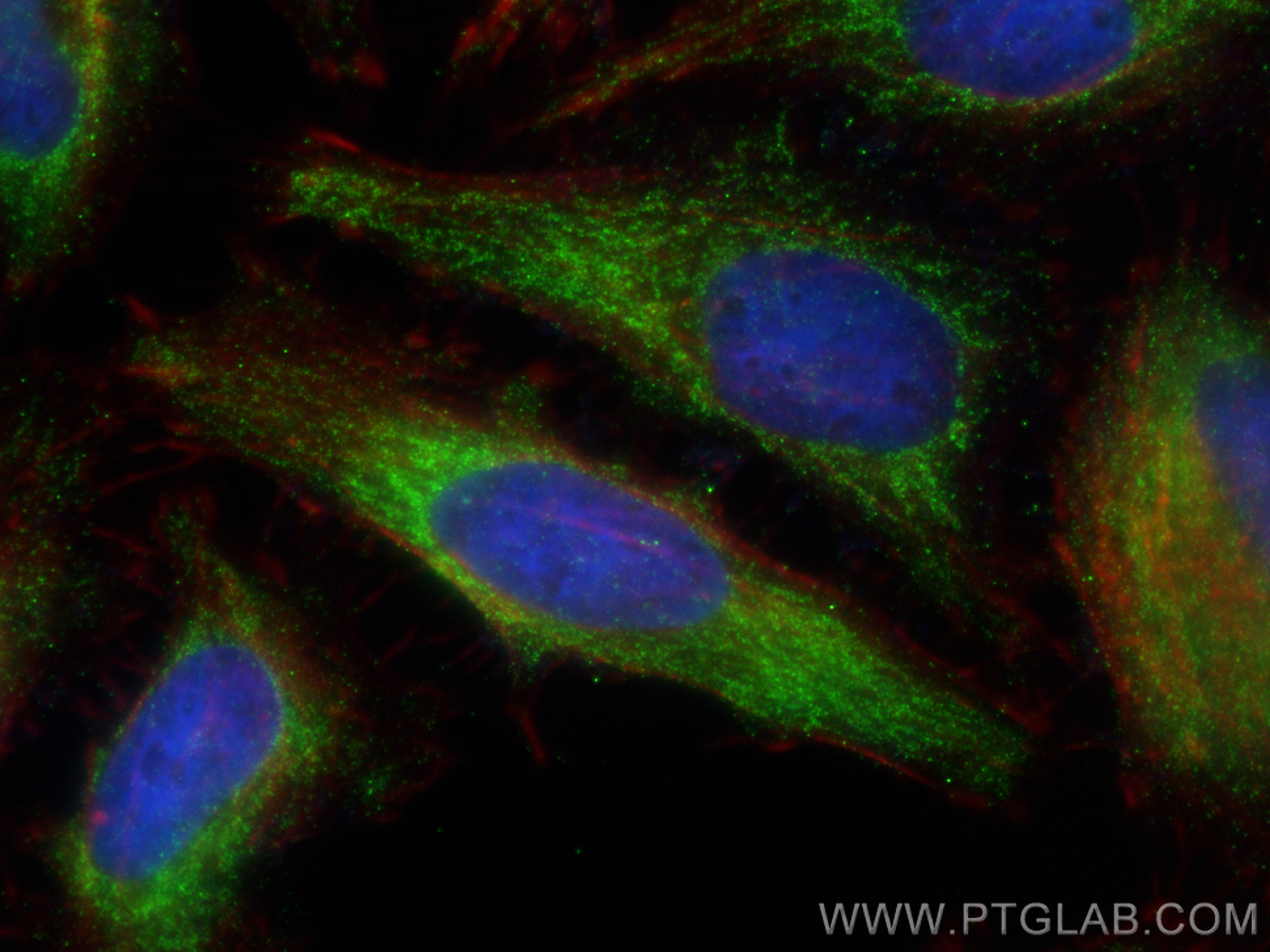 Immunofluorescence (IF) / fluorescent staining of HeLa cells using NDUFS1 Monoclonal antibody (68253-1-Ig)