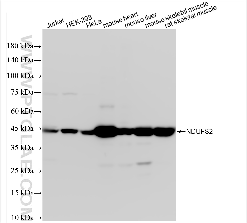 Western Blot (WB) analysis of various lysates using NDUFS2 Recombinant antibody (84880-1-RR)