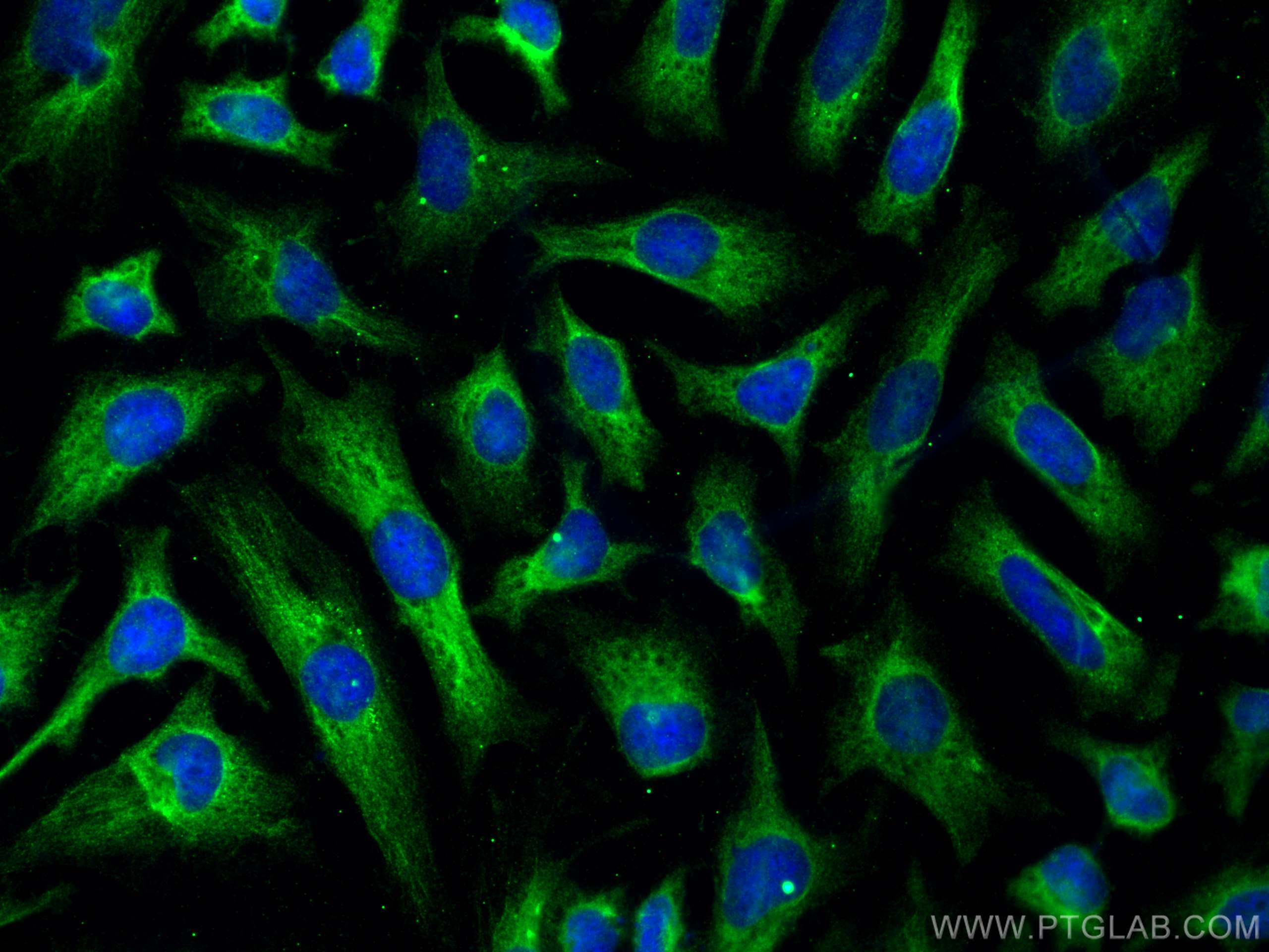 Immunofluorescence (IF) / fluorescent staining of HeLa cells using NDUFS7 Polyclonal antibody (15728-1-AP)