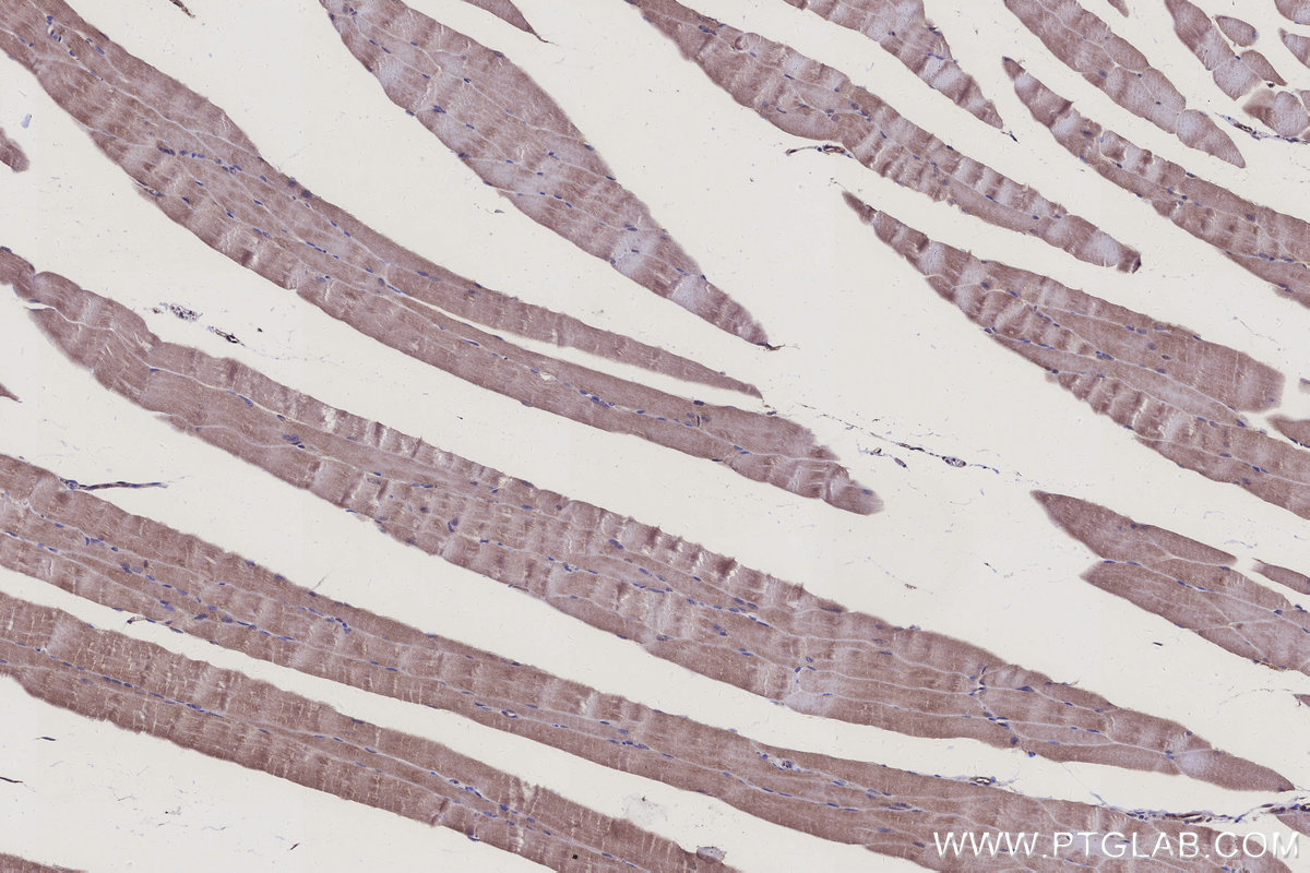 Immunohistochemistry (IHC) staining of mouse skeletal muscle tissue using NDUFS7 Polyclonal antibody (15728-1-AP)
