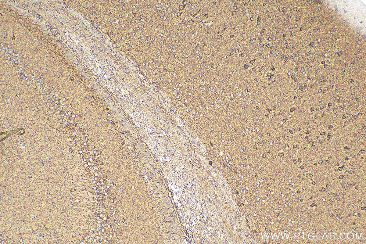 Immunohistochemistry (IHC) staining of mouse brain tissue using NDUFV2 Polyclonal antibody (15301-1-AP)