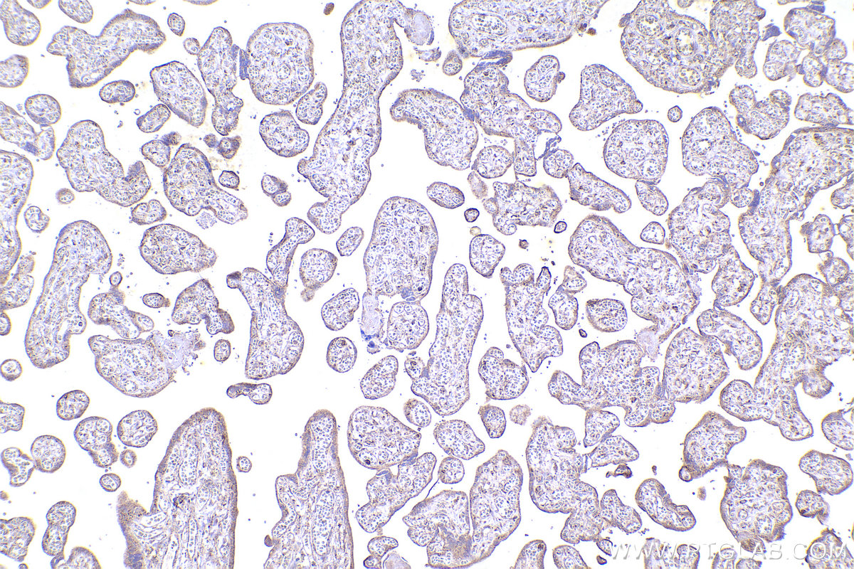 Immunohistochemistry (IHC) staining of human placenta tissue using NDUFV3 Polyclonal antibody (13430-1-AP)