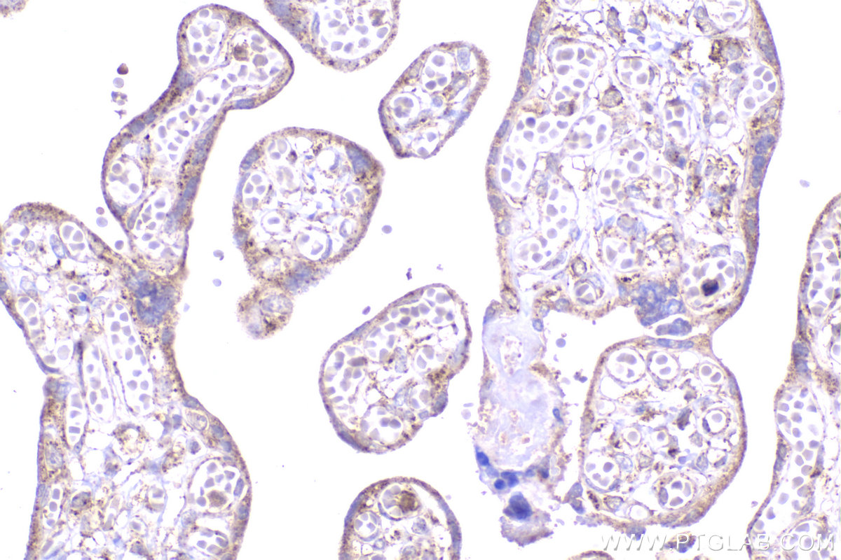 Immunohistochemistry (IHC) staining of human placenta tissue using NDUFV3 Polyclonal antibody (13430-1-AP)