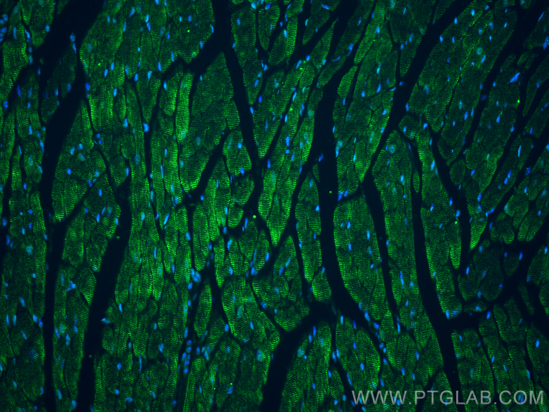 Immunofluorescence (IF) / fluorescent staining of mouse heart tissue using NEBL Polyclonal antibody (21497-1-AP)