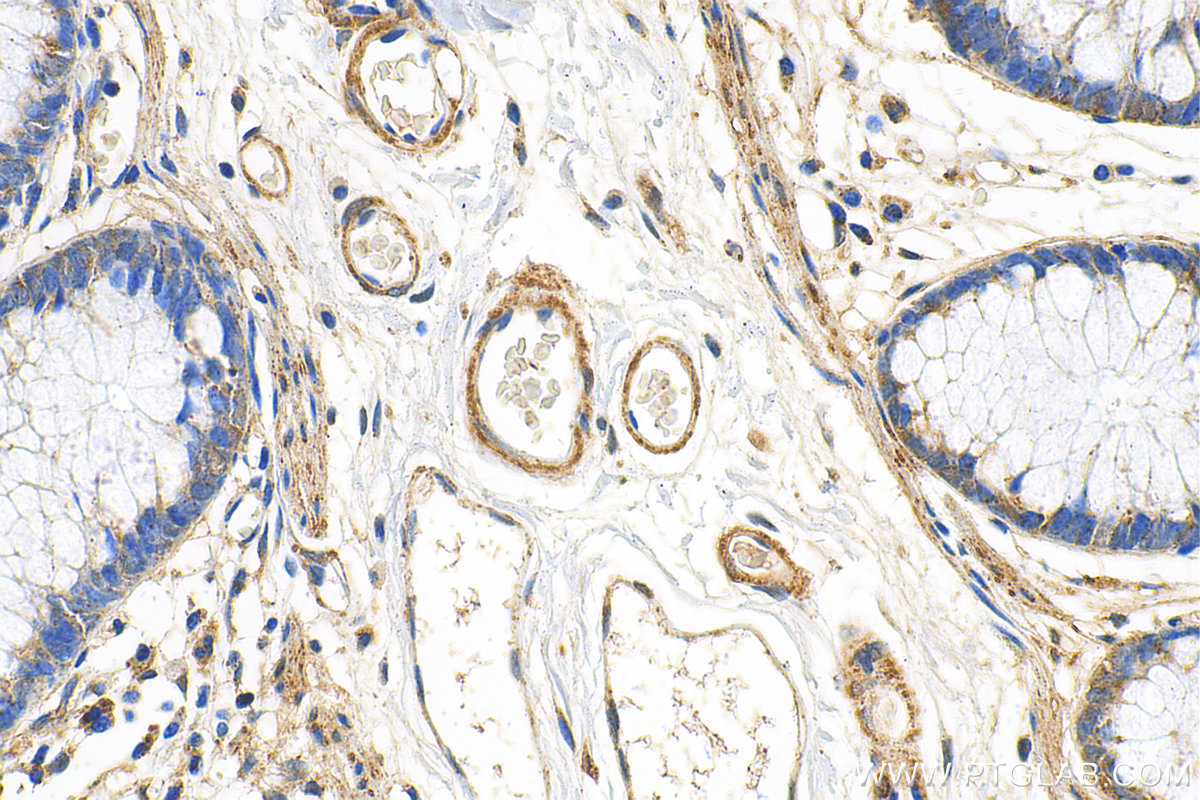 Immunohistochemistry (IHC) staining of human colon tissue using NEDD1 Polyclonal antibody (13993-1-AP)