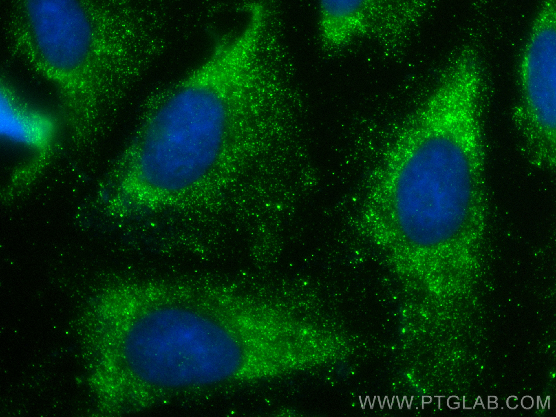 Immunofluorescence (IF) / fluorescent staining of U2OS cells using NEDD4 Recombinant antibody (83112-1-RR)